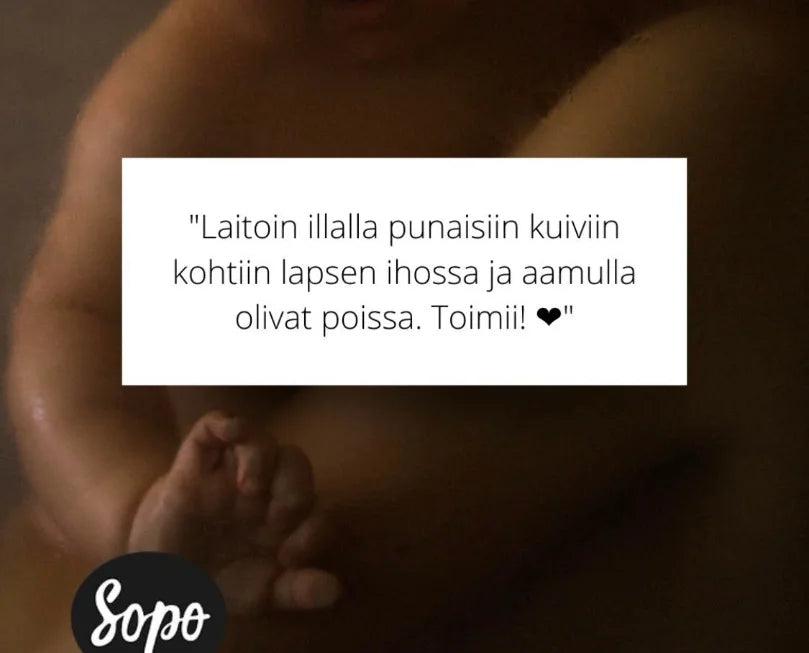 metsäbiomi voidepala suosittelu kokemus