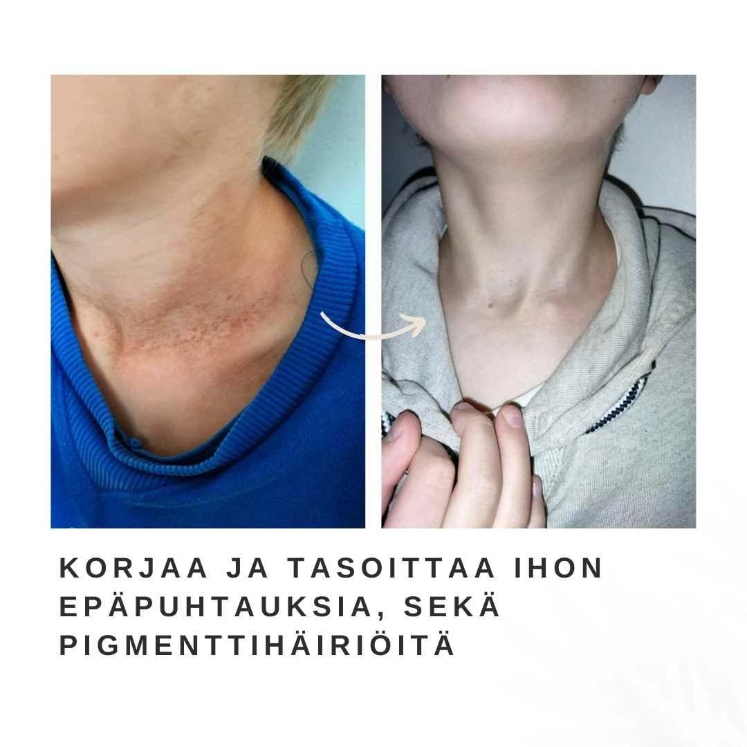 kauneusöljy korjaa ja tasoittaa ihoa